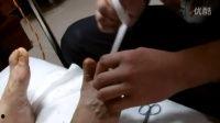 修脚手法视频