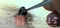 洗肚脐视频